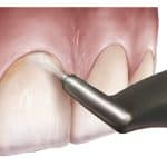 Celebrating Mom with a Smile: Mother’s Day and the Importance of Dental Care