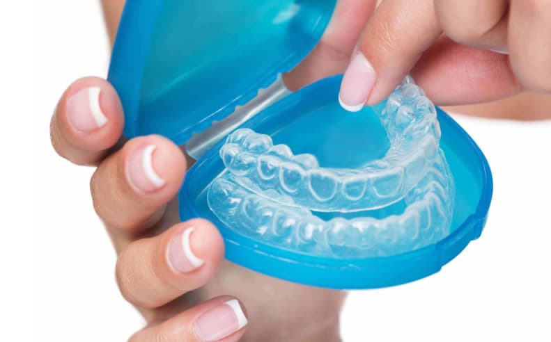 New Approach for Smile Designing: Clear Aligners