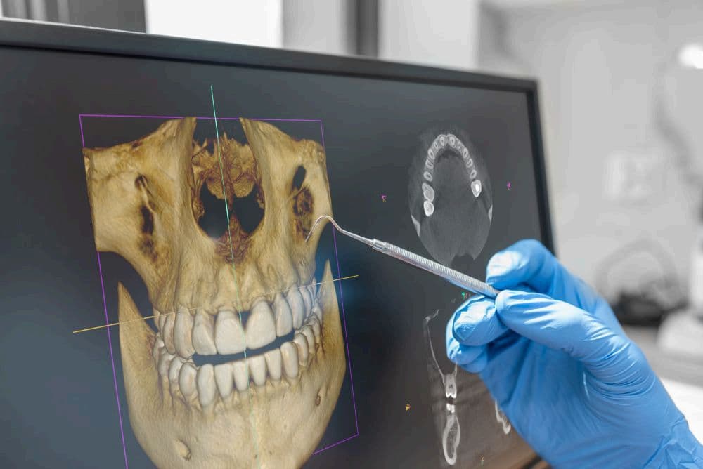 What Every Patient NEEDS to Know About Dental X-Rays and Safety