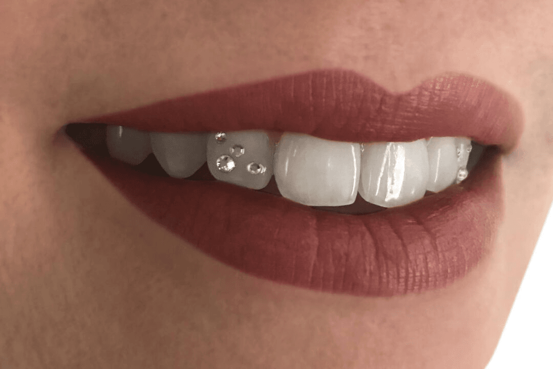Tooth Jewellery
