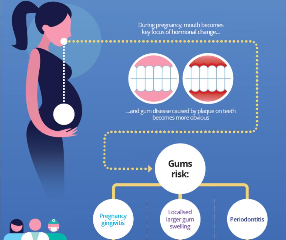 Pregnancy Gingivitis